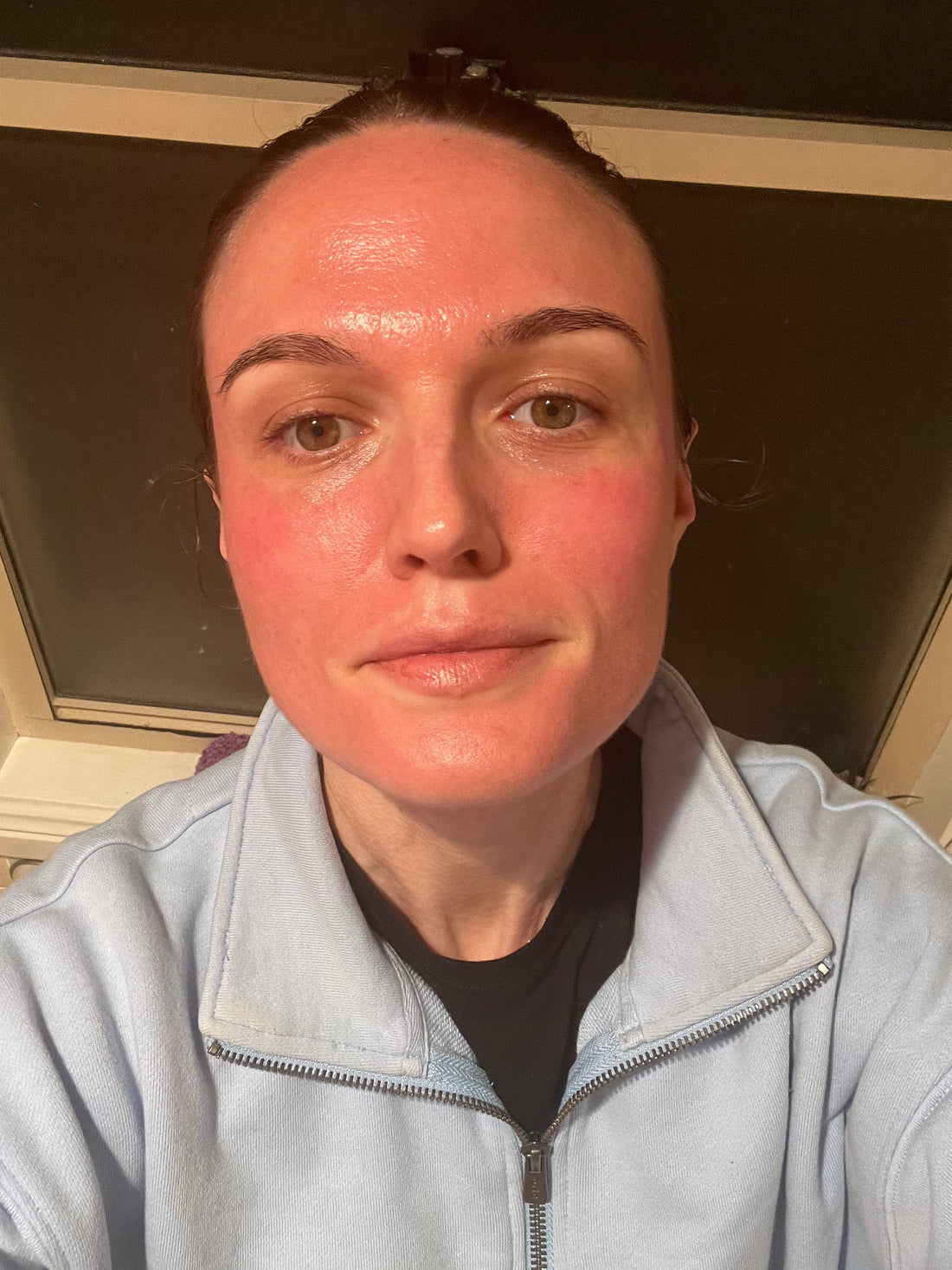 image of skin needling results, red face and swollen